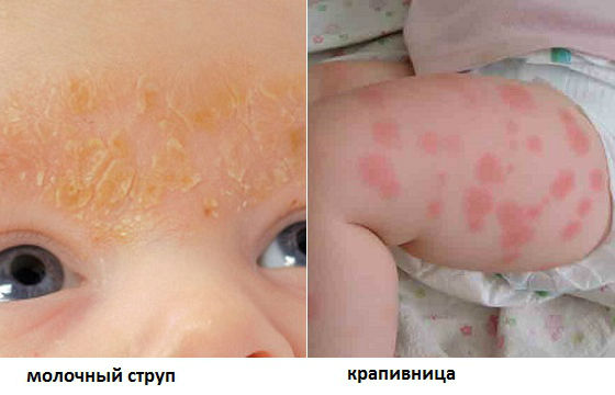 Реакция у грудничка на молоко и молочную смесь