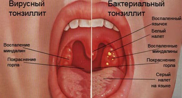Симптомы насморк и кашель