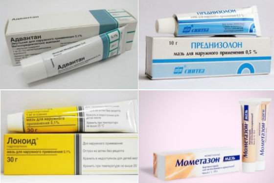 Кортикостероиды для лечения аллергических реакций