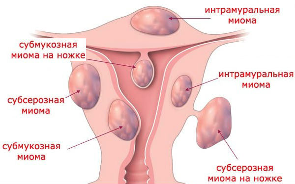 Чем вылечить ребенка от кашля в домашних условиях