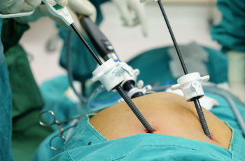 Интимное здоровье :: Лапароскопия маточных труб: как проводится, преимущества и недостатки