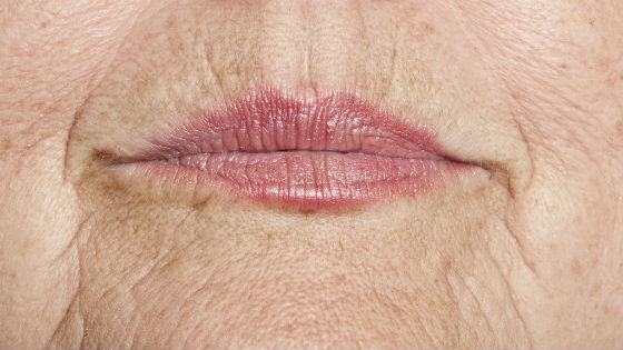 Уход за кожей :: Методы и средства убрать кисетные морщины над верхней губой