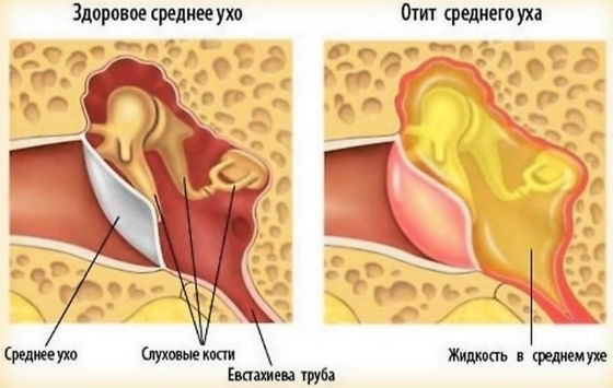 Нервный стресс симптомы и лечение у ребенка