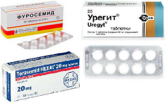 Петлевые диуретики для снятия отечности