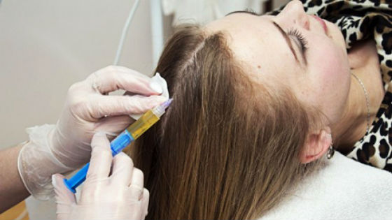 Салонные процедуры по укреплению волосяных фолликулов