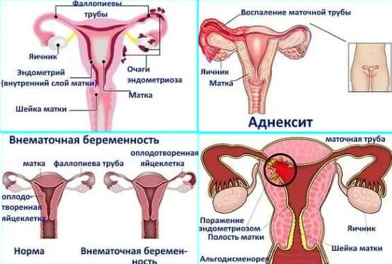 Овуляторный синдром, симптомы - Клиника Здоровье г. Екатеринбург Почему тянет низ живота после овуляции