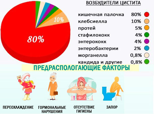 Причины и риски развития воспаления мочевого пузыря
