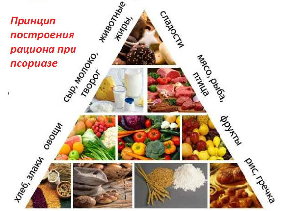 Виды диет :: Диета при псориазе: принципы питания, таблица разрешенных и запрещенных продуктов, подробное меню на неделю