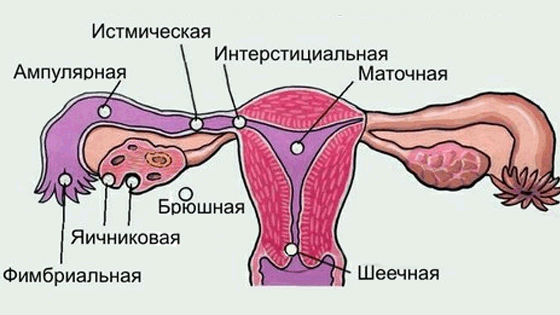 Плодное яйцо способно закрепиться в любом органе половой системы