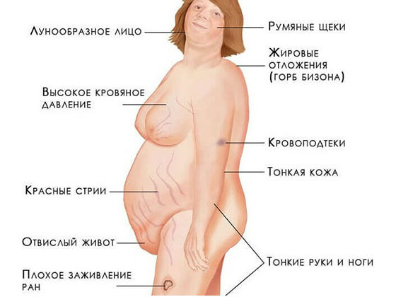 Признаки избытка кортизола в организме