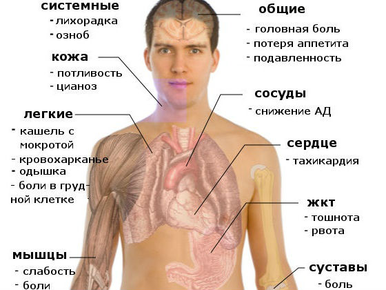 Общие признаки пневмонии
