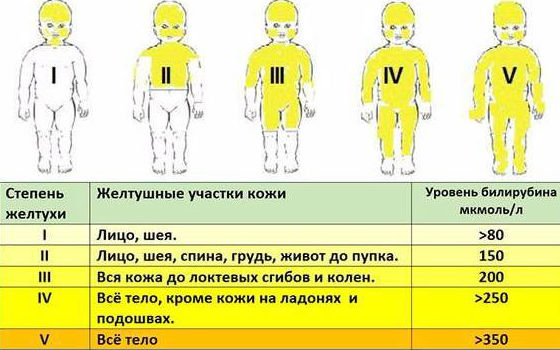 Степени желтушки по распространению окрашивания кожных покровов