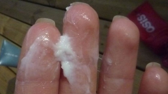 молочница фото у женщин выделения онлайн молочница фото у женщин выделения