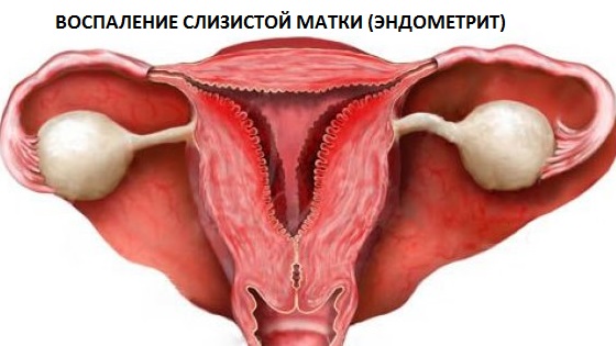 Выделяется кровь но не месячные Выделяется кровь но не месячные